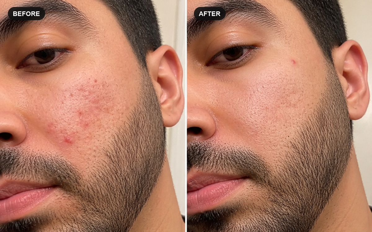 Close-up illustrative before and after comparison for a simple beauty routine