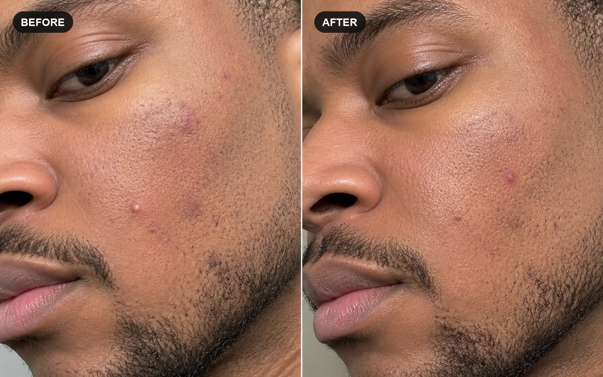 Close-up illustrative before and after comparison for a GLP-1 self-care routine