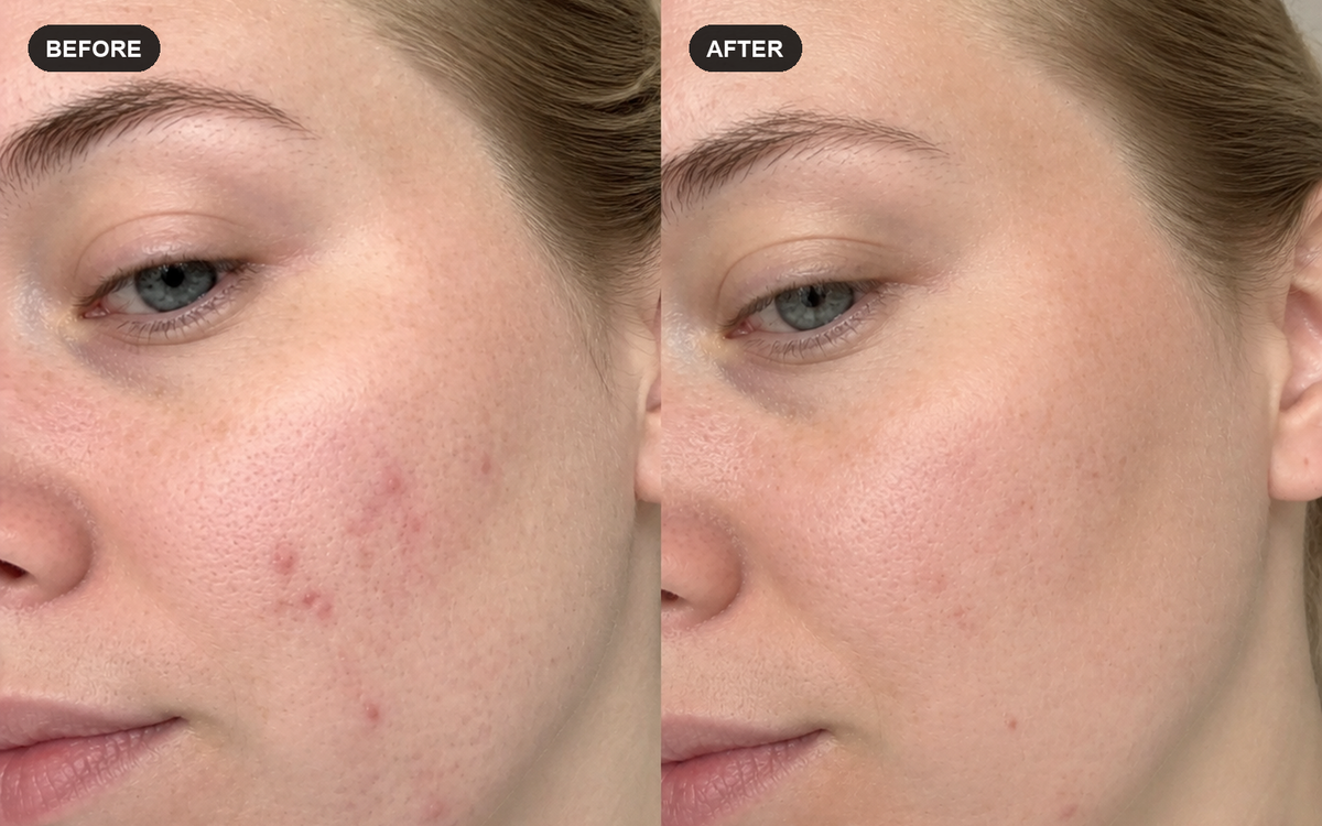 Close-up illustrative before and after comparison for hair-loss-conscious women