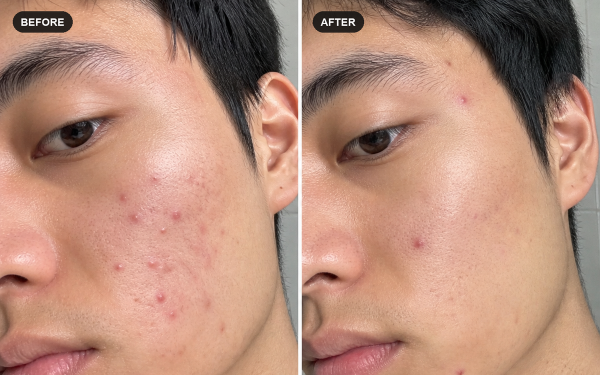Close-up illustrative before and after comparison for a 30-night silk pillowcase trial
